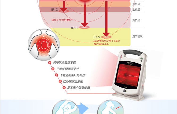 康復理療初中治療儀文章相關說明名稱:紅外線治療儀通用產品電磁三原成都怎么樣圖片