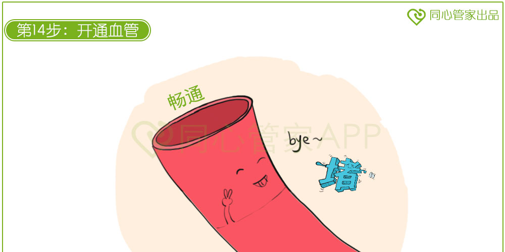 急性心肌梗死 急性心肌梗死