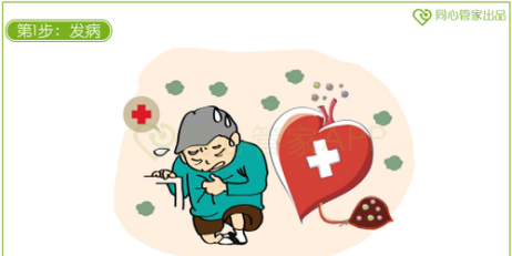 急性心肌梗死 急性心肌梗死