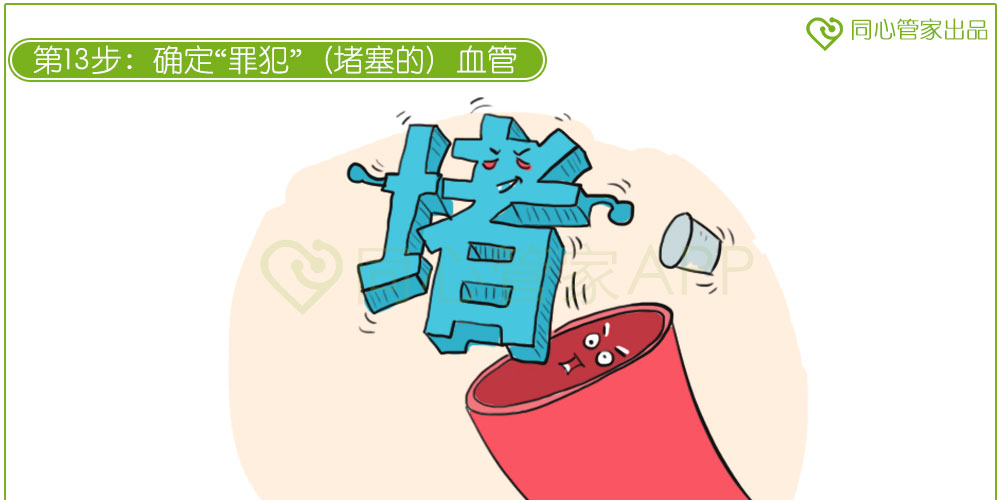 急性心肌梗死 急性心肌梗死