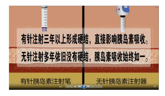 无针注射器 无针注射器