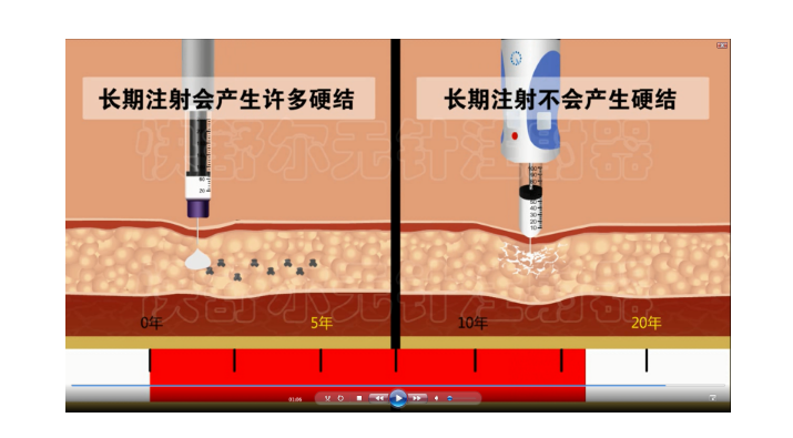 无针注射器 无针注射器